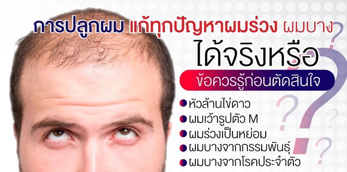 ปลูกผมแล้วต้องกินยาไปตลอดชีวิตหรือไม่?