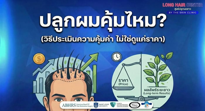 ปลูกผมคุ้มไหม? (วิธีประเมินความคุ้มค่า ไม่ใช่ดูแค่ราคา)