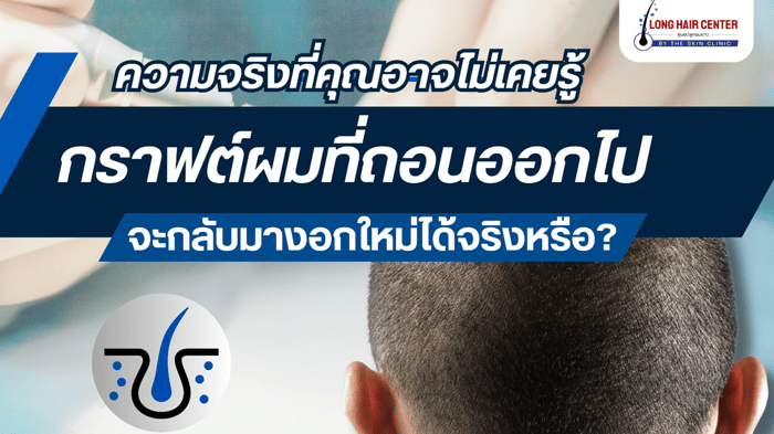 ปลูกผมแล้วต้องกินยาไปตลอดชีวิตหรือไม่?