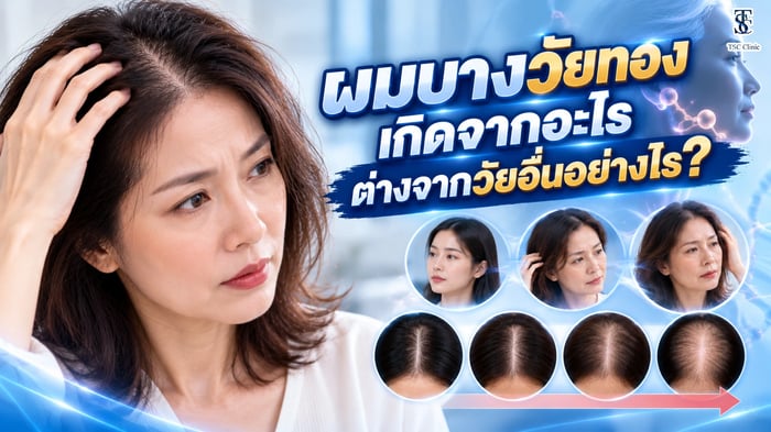 ผมบางวัยทอง เกิดจากอะไร ต่างจากผมบางวัยอื่นอย่างไร