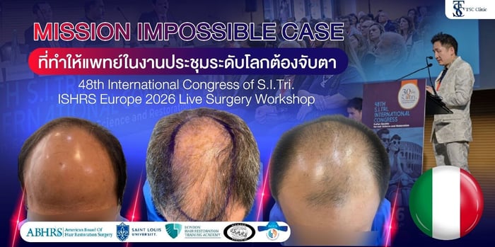 หัวล้าน