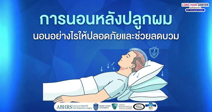 การนอนหลังปลูกผมอย่างไรให้ปลอดภัยและลดบวม