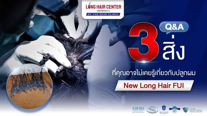 New Long Hair FUI : 3 สิ่งที่คุณไม่เคยรู้เกี่ยวกับปลูกผม