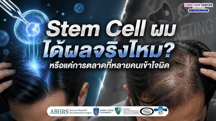 Stem Cell ผม ได้ผลจริงไหม? หรือแค่การตลาดที่หลายคนเข้าใจผิด