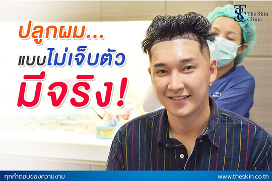 ปลูกผมแบบไม่เจ็บตัว มีจริง!!!