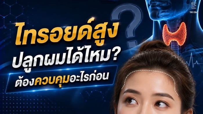 ผู้หญิงที่มีโรคไทรอยด์ ปลูกผมได้ไหม ต้องควบคุมอะไรก่อน