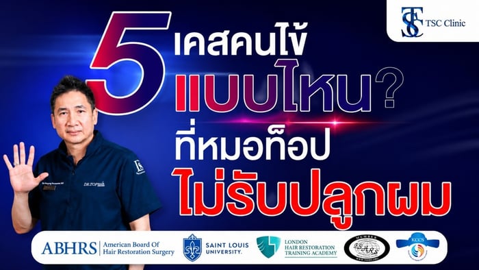 แบบไหนไม่ควรปลูกผม ? 5 เคสที่แพทย์อาจไม่แนะนำให้ทำ