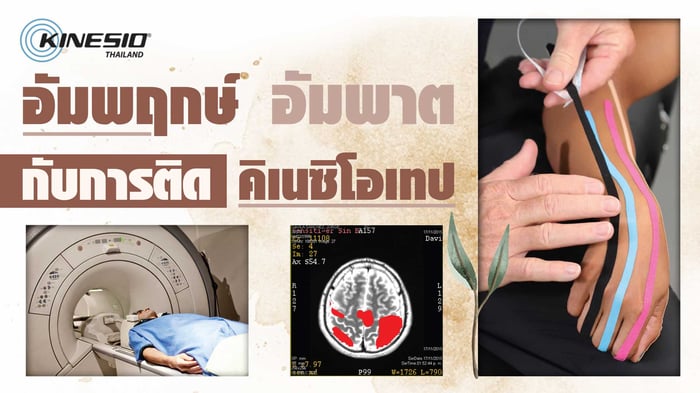 การใช้ผ้าเทป Kinesio กับผู้ป่วยพยาธิสภาพหลอดเลือดสมอง (อัมพาต/อัมพฤกษ์)