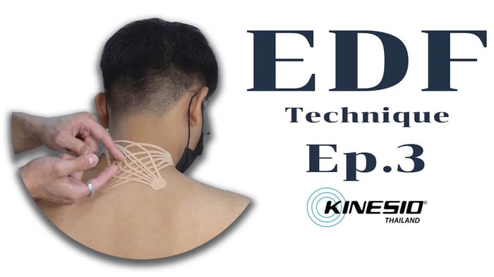 เทคนิค EDF กับอาการปวดร้าวบริเวณคอ (Whiplash) [EP.3]