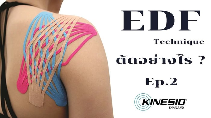 การติดเทป Kinesio เทคนิค EDF ตัดอย่างไร ? [EP2]