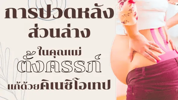 อาการปวดหลังส่วนล่างในคุณแม่ตั้งครรภ์แก้ด้วยคิเนซิโอเทป