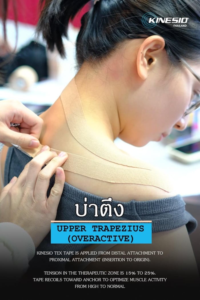 อาการยอดฮิตของหนุ่มๆสาวๆ วัยทำงาน “อาการบ่าตึง”