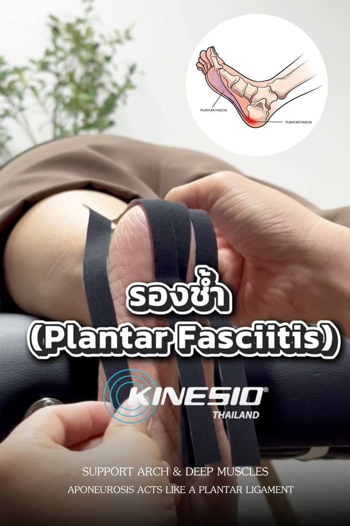 โรครองช้ำ (Plantar Fasciitis)