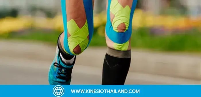 เทปบำบัด เทคนิคลดอาการปวดที่คนออกกำลังกายควรรู้