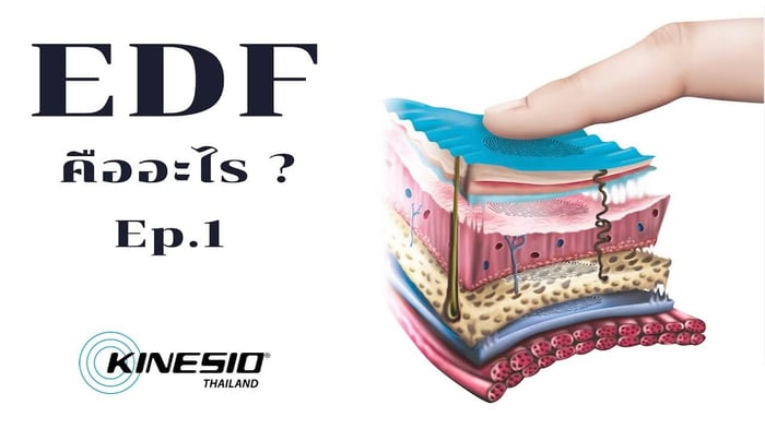 การติดเทป Kinesio เทคนิค EDF คืออะไร ? [EP 1]