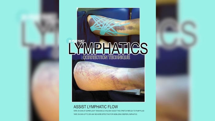 kinesio-tape-for-bruises-how-it-works-and-benefits