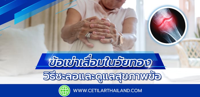 ข้อเข่าเสื่อมในวัยทอง: วิธีชะลอและดูแลสุขภาพข้อ