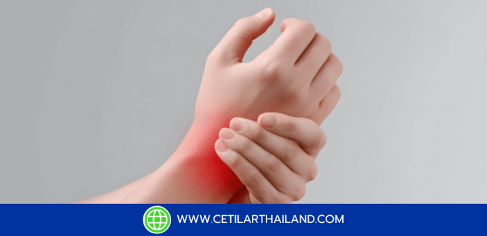 ปวดข้อมือ ปวดข้อนิ้วมือ ต้องรู้! งานวิจัยใหม่เผยครีมทา CFA ช่วยลดอาการปวดได้?