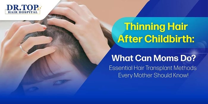 Thinning Hair After Childbirth: What Can Moms Do? Essential Hair Transplant Methods Every Mother Should Know!