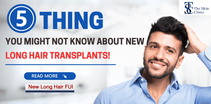 5 Things You Might Not Know About New Long Hair Transplants!