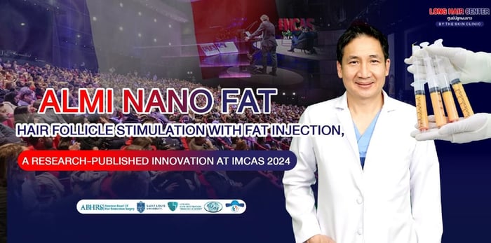 ALMI Nano Fat: Hair Follicle Stimulation with Fat Injection, A Research-Published Innovation at IMCAS 2024