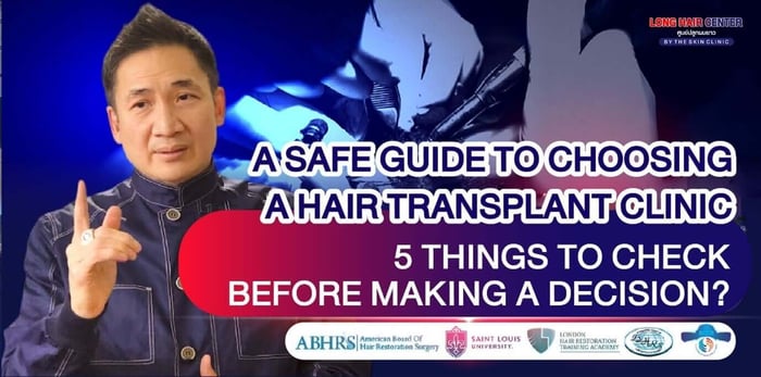 5 Must-Know Things Before Choosing a Safe Hair Transplant Clinic