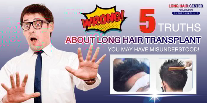 5 Truths About Long Hair Transplant You Need to Know