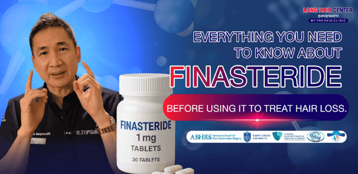 Hair Loss Treatment : Everything You Need to Know About Finasteride