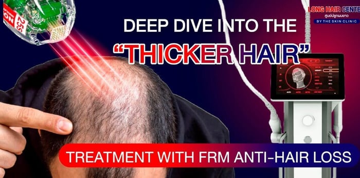 Deep Dive into the “Thicker Hair” Treatment with FRM Anti-Hair Loss