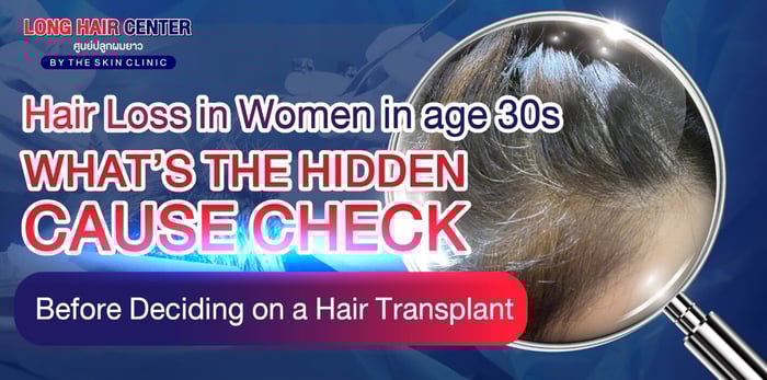 Hair Loss in 30s Women: Know the Cause Before Transplant