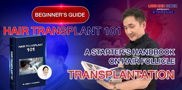 Beginner’s Guide: Hair Transplant 101 – What You Need to Know