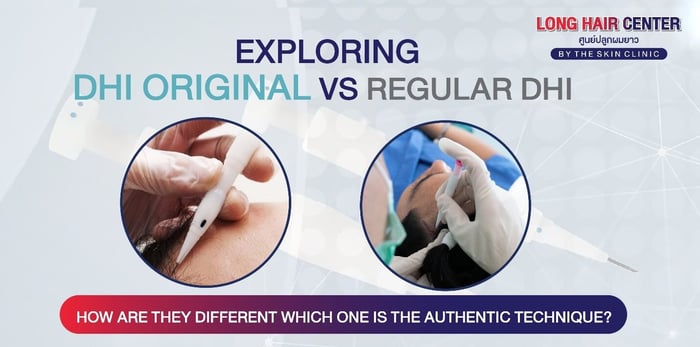 DHI Original vs DHI Technique: What’s the Difference?