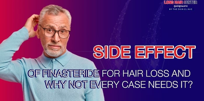 Fact you must know about medication after hair transplant