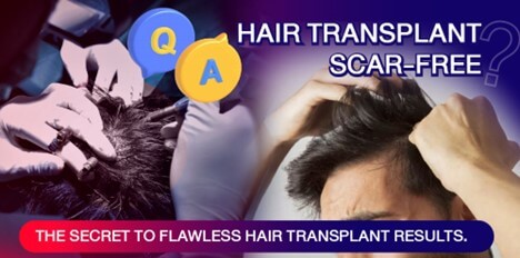 Hair Transplant Scar-Free? The Secret to Flawless Hair Transplant Results.