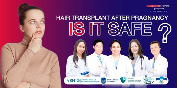 Hair Transplantation After Pregnancy, Is It Possible?