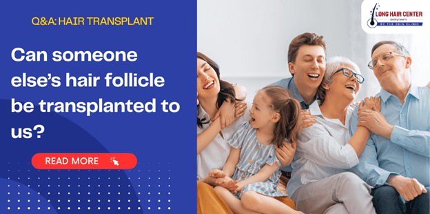 Frequently asked question about Hair Transplant: Can someone else’s hair follicle be transplanted to us?
