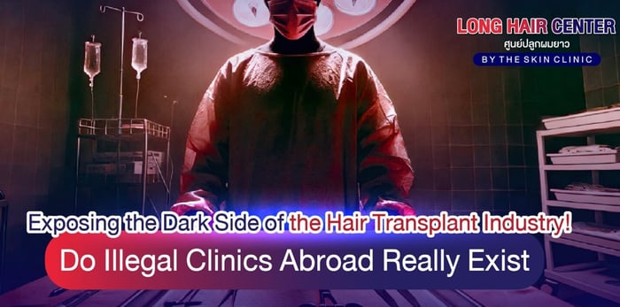 The Dark Side of Hair Transplants: Do Illegal Clinics Exist?