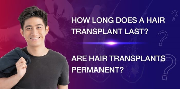 How Long Does a Hair Transplant Last? Are hair transplants permanent?
