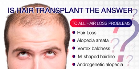 Is Hair Transplant the Answer to All Hair Loss Problems?
