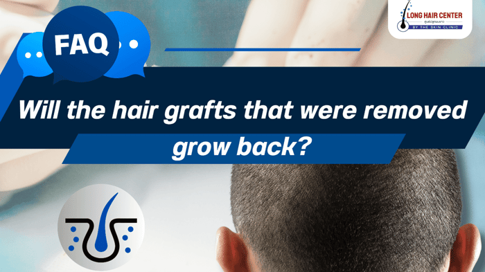 Hair transplant : Surprising Truth! Will the hair grafts that were removed grow back?