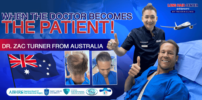 Real Case! Australian Doctor Flies to Thailand for Hair Restoration with Dr. Top, Long Hair x ALMI Nano Fat