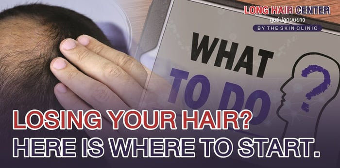 Losing Your Hair? Here is Where to Start.