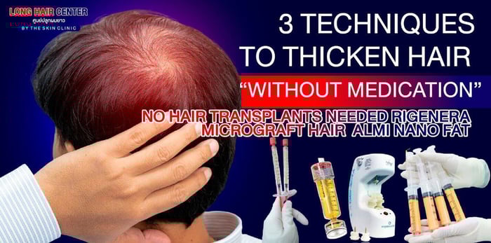3 Techniques to Thicken Hair: No Transplant Needed
