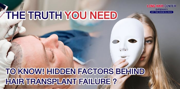 The Truth You Need to Know! Hidden Factors Behind Hair Transplant Failure.