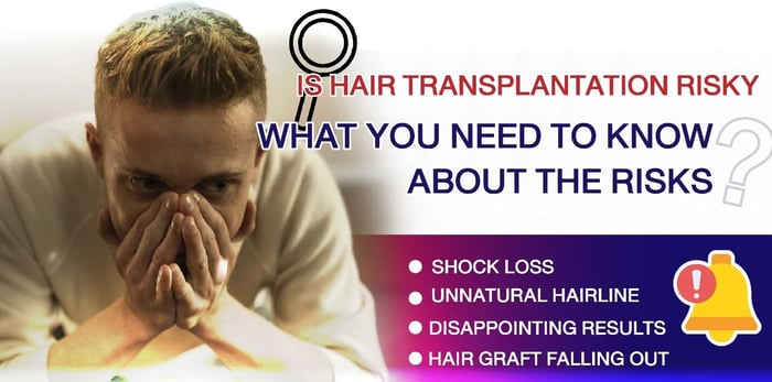 Thinking About a Hair Transplant Here's What You Need to Know About the Risks