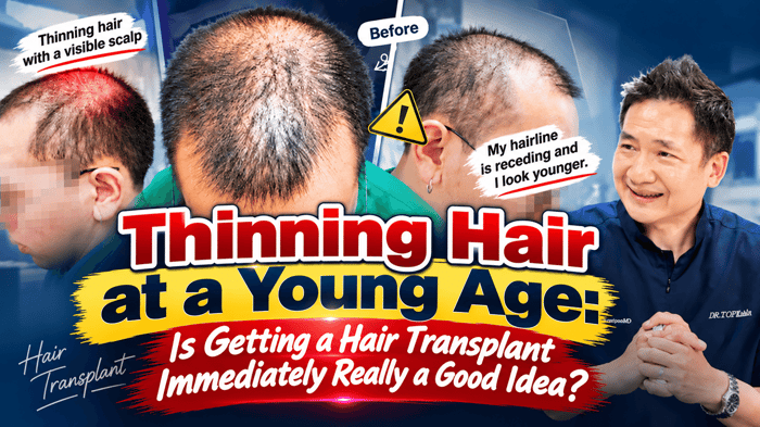 Thinning Hair at a Young Age: Is Getting a Hair Transplant Immediately Really a Good Idea? Check the Facts Before Making a Decision