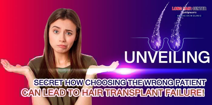 Unveiling the Secret: How Choosing the Wrong Patient Can Lead to Hair Transplant Failure