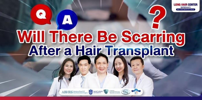 Will There Be Scarring After a Hair Transplant?