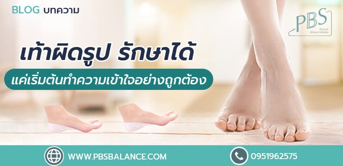 เท้าผิดรูป รักษาได้ แค่เริ่มต้นทำความเข้าใจอย่างถูกต้อง
