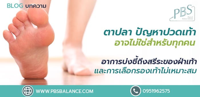 ตาปลา ปัญหาเท้าแสนเจ็บปวด อาการบ่งชี้ถึงสรีระของฝ่าเท้าผิดปกติและการเลือกรองเท้าไม่เหมาะสม